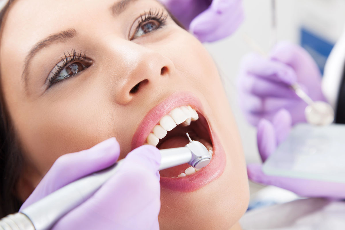 Invisalign IPR (Stripping): A Complete Guide